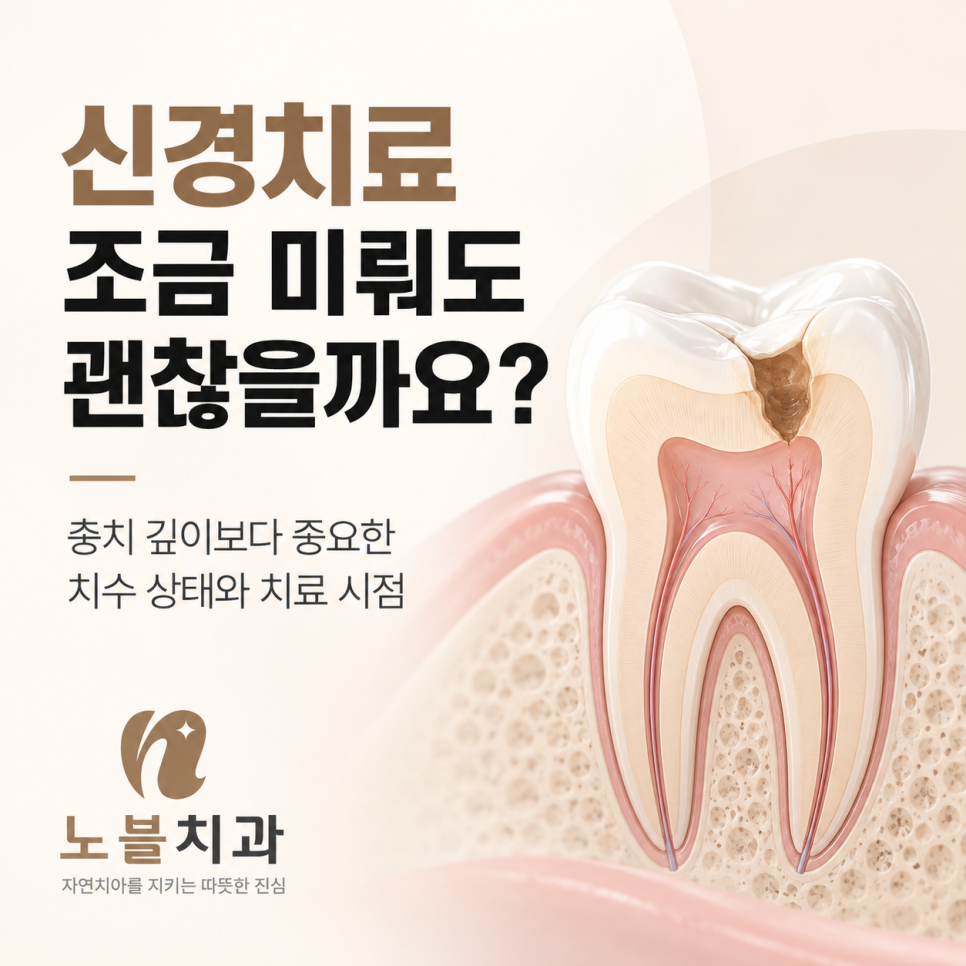 충치 깊이보다 중요한 치수 상태와 치료 시점