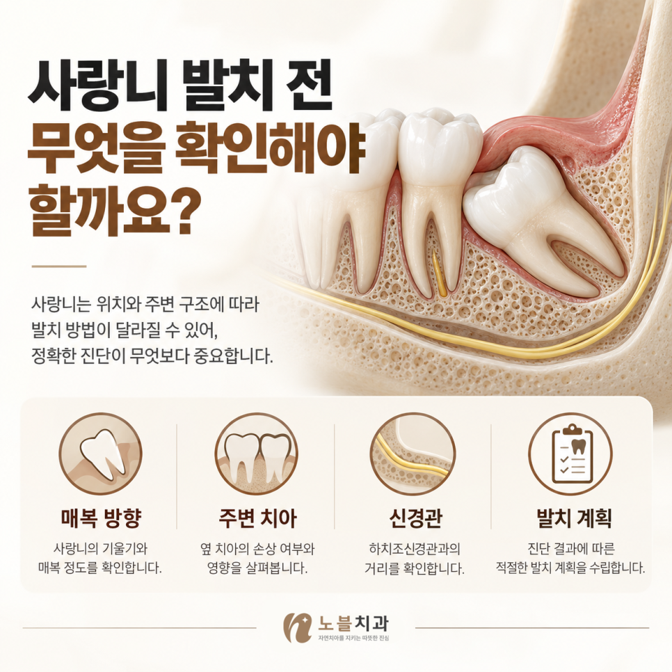 사랑니마다 발치 기준과 난이도는 다릅니다.