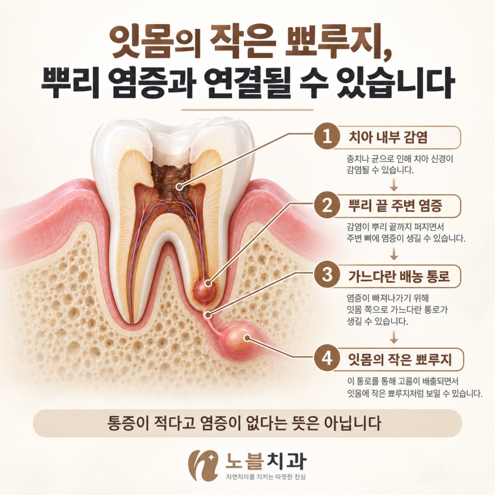 통증이 적다고 염증이 없다는 뜻은 아닙니다.