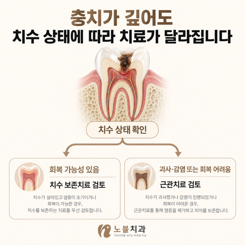 깊이만 보지 않고 치아 신경의 상태를 함께 확인합니다.