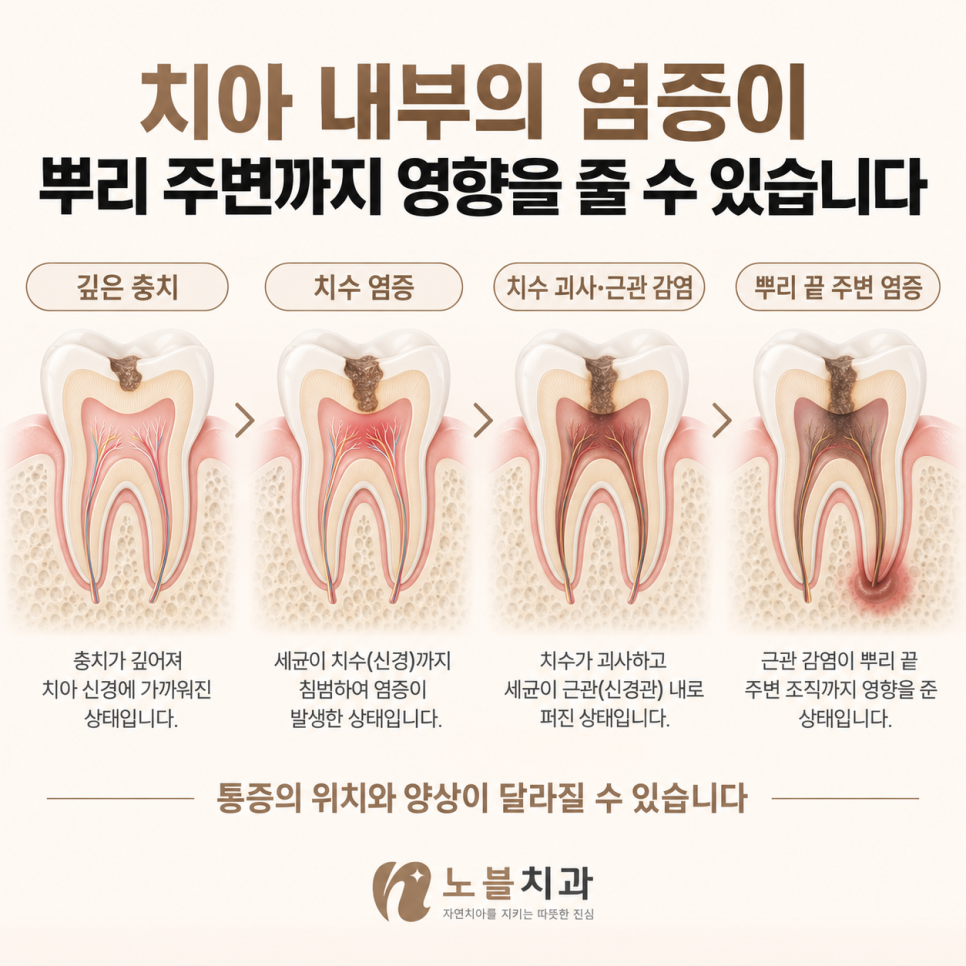 통증의 위치와 양상이 달라질 수 있습니다