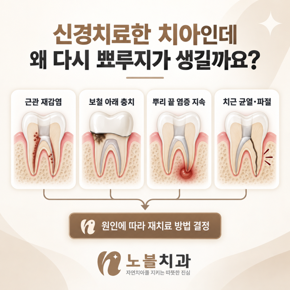 원인에 따라 재치료 방법 결정