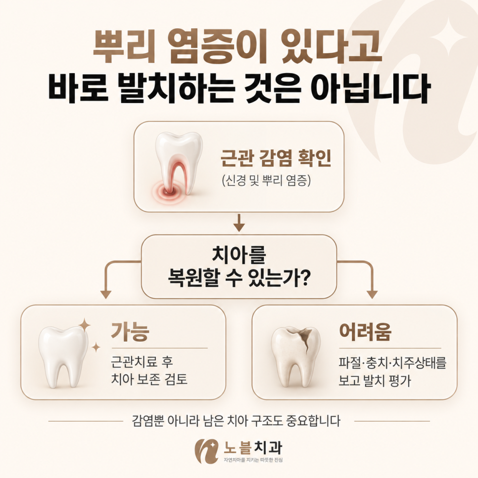 치료 가능성은 감염뿐 아니라 남은 치아 구조도 중요합니다.