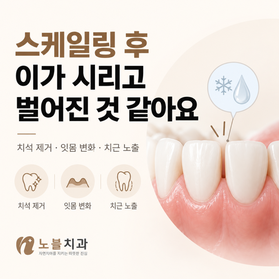 수원 조원동 치과 스케일링 후 이가 시리고 벌어진 것 같은데, 괜찮을까요?