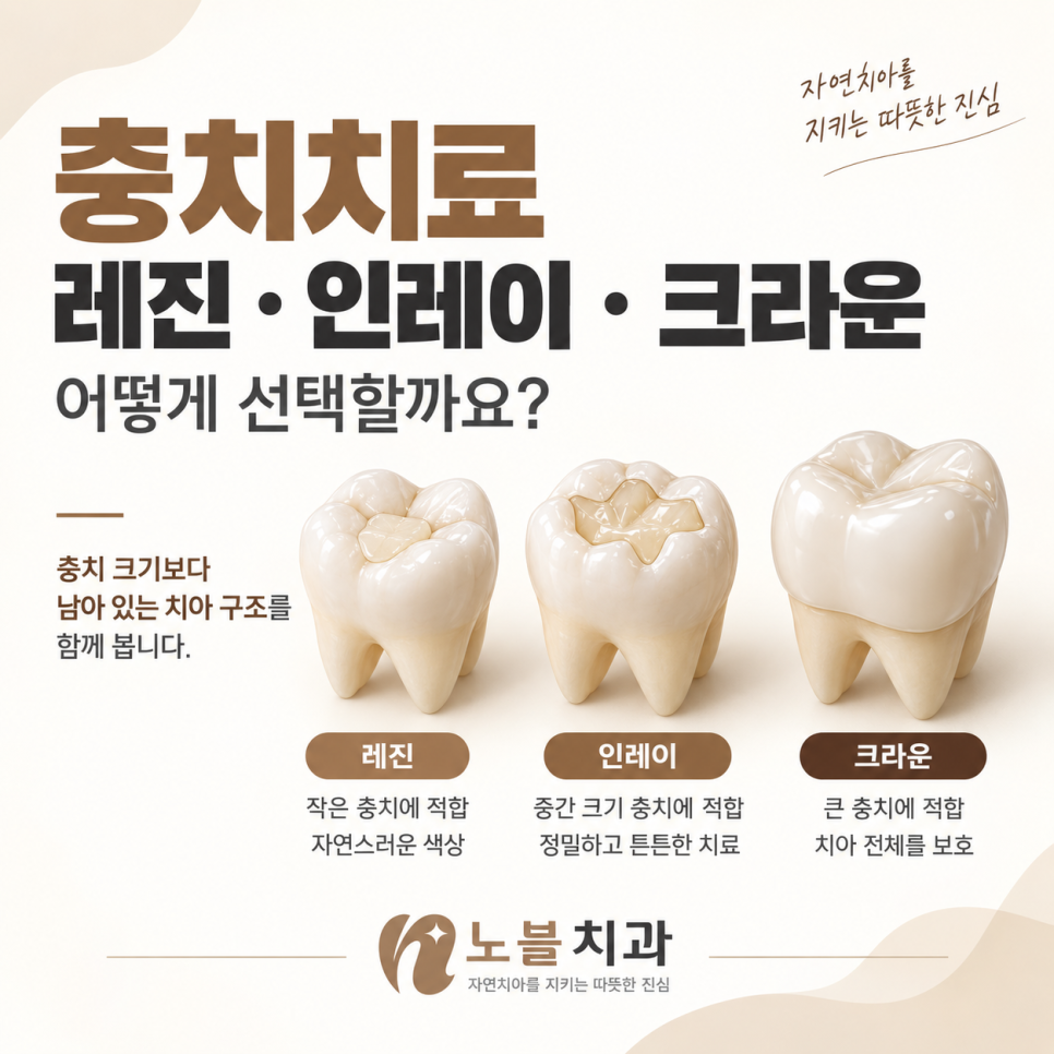 장안구치과 충치치료, 레진·인레이·크라운은 어떻게 선택할까요?