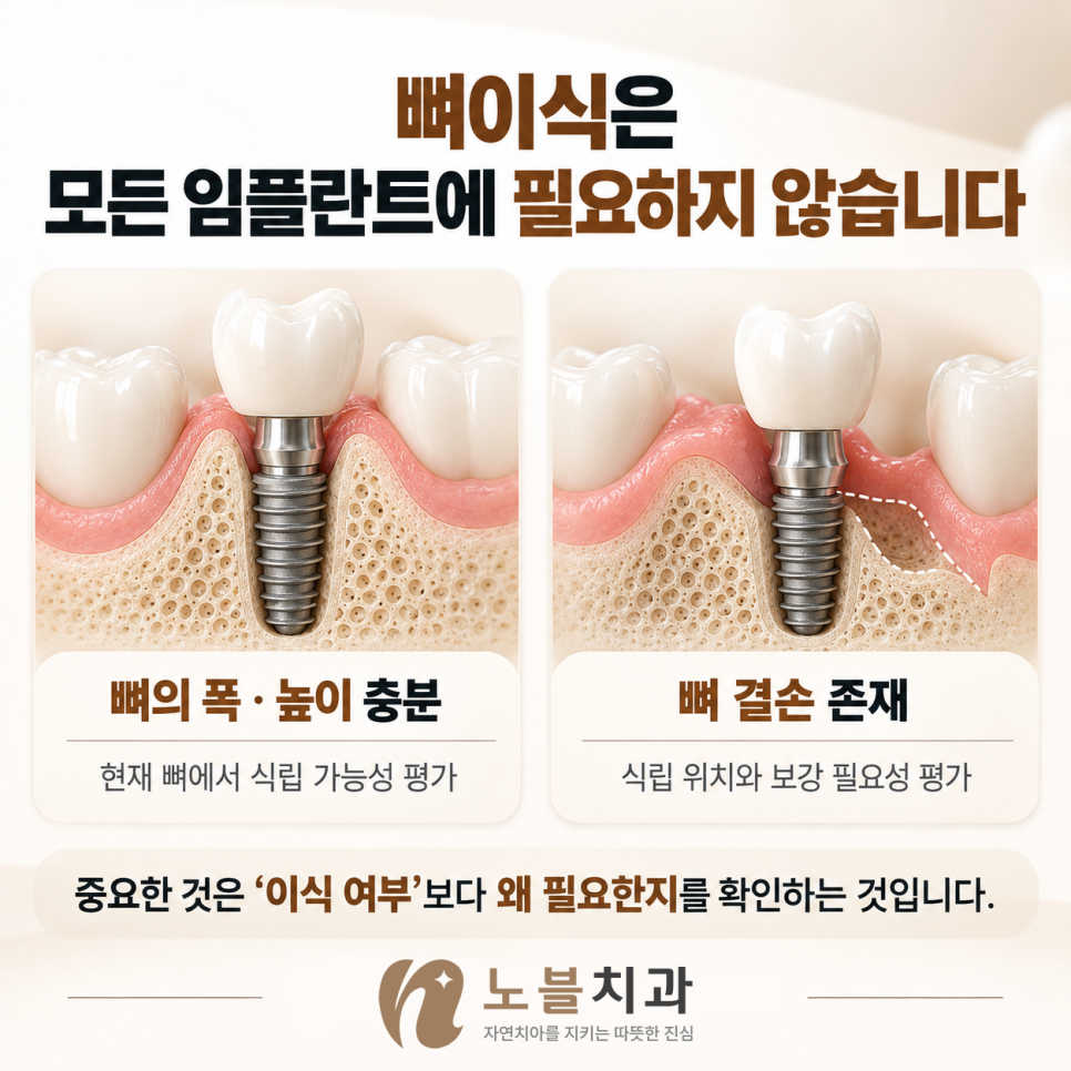 빠른 방법보다 현재 상태에 맞는 진료가 중요합니다.