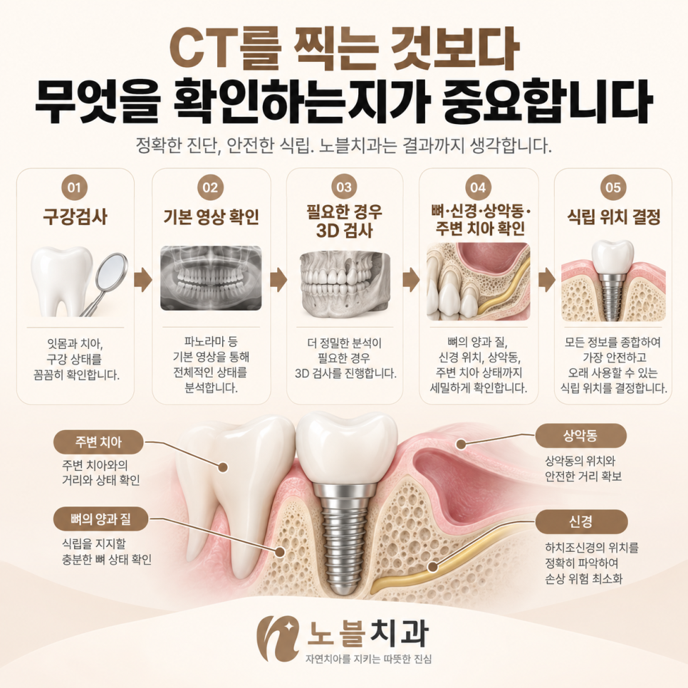 수원 임플란트 치과 선택 전 체크할 것, 진단부터 사후관리까지
