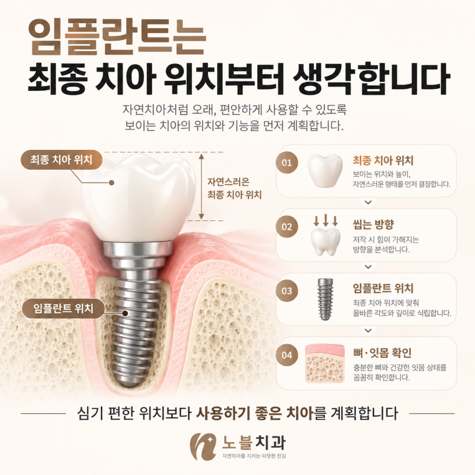 심기 편한 위치가 아니라 사용하기 좋은 치아를 만드는 것이 목표입니다.
