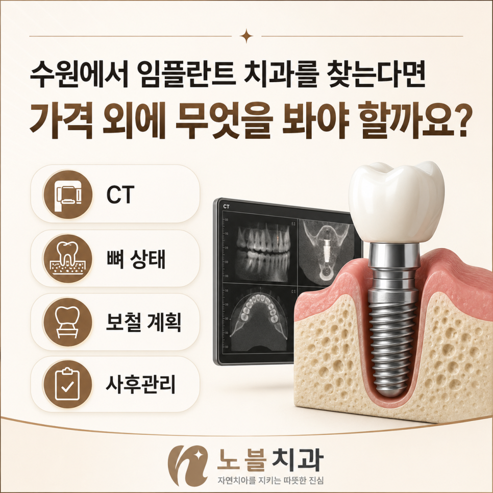 CT · 뼈 상태 · 보철 계획 · 사후관리 비교할 기준부터 정리해봅니다.