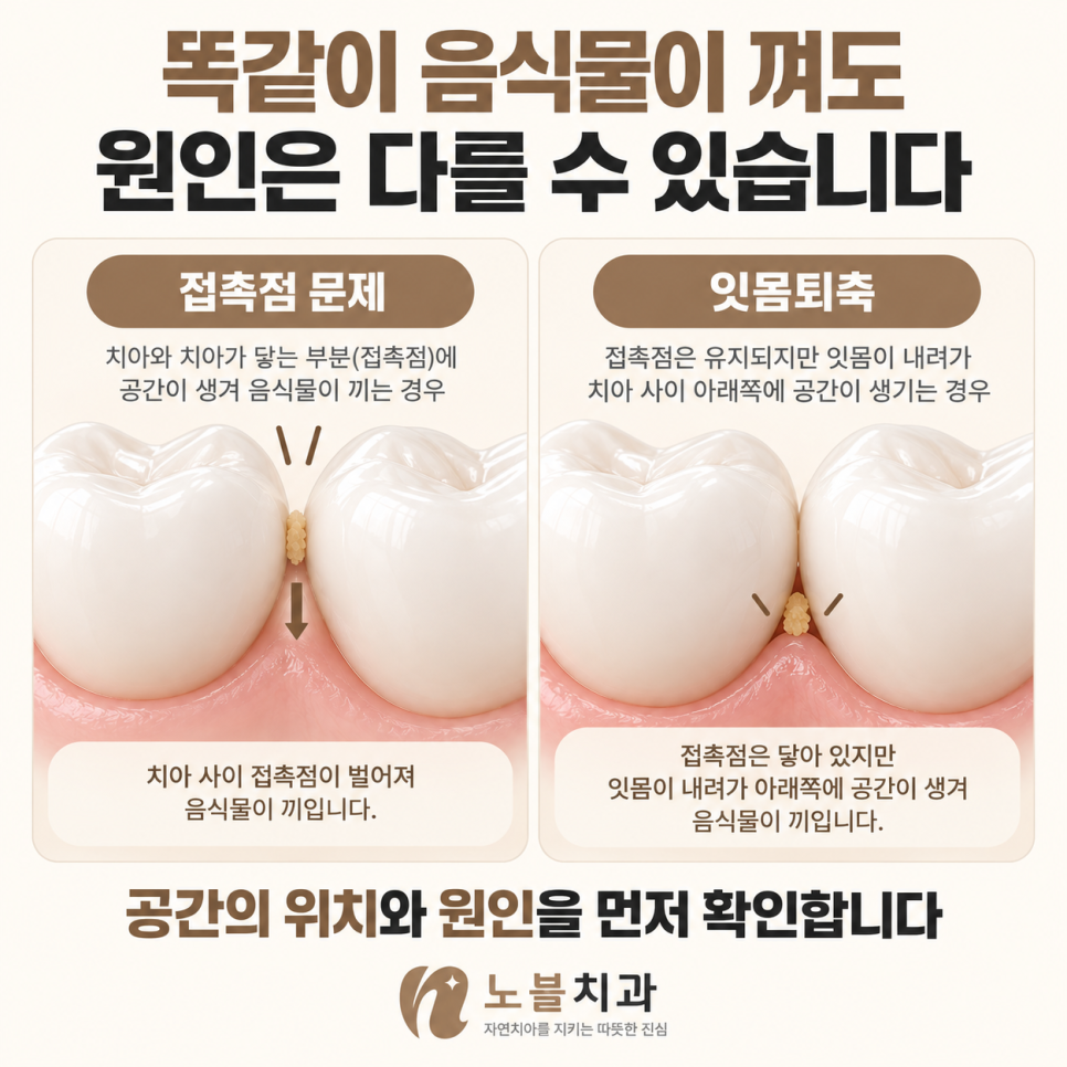 공간의 위치와 원인을 확인해야 관리 방법을 정할 수 있습니다.