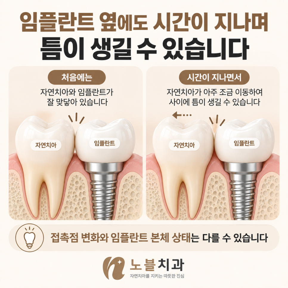 치료 직후 괜찮았더라도 정기적으로 접촉상태를 확인합니다.
