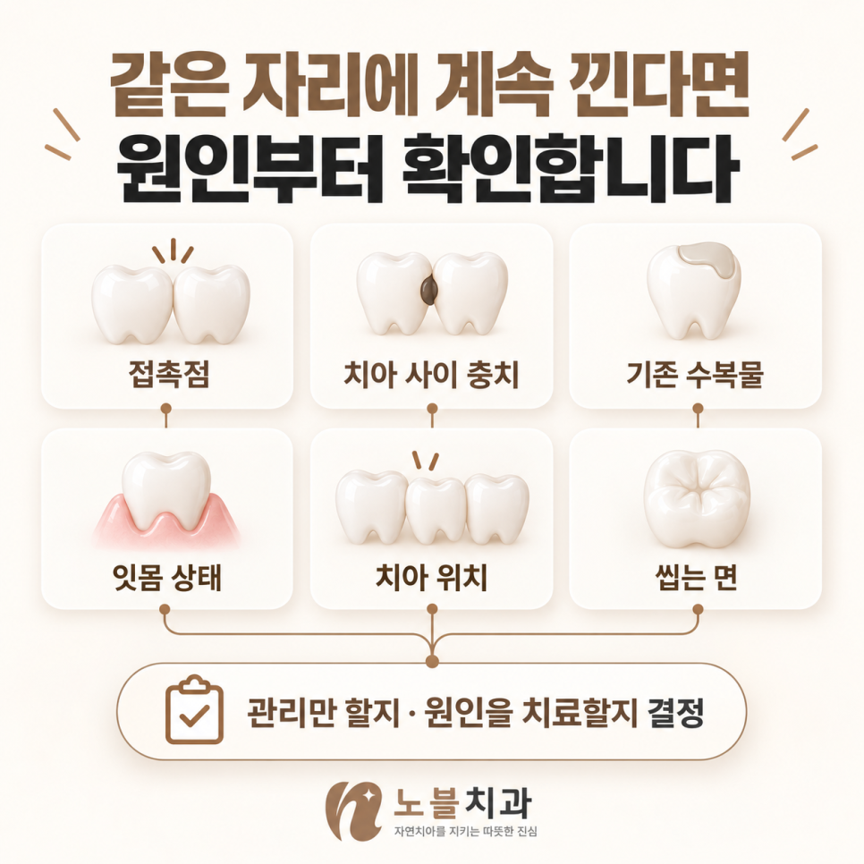 수원 파장동 치과 치아 사이에 음식물이 자꾸 끼는데, 치료가 필요할까요?