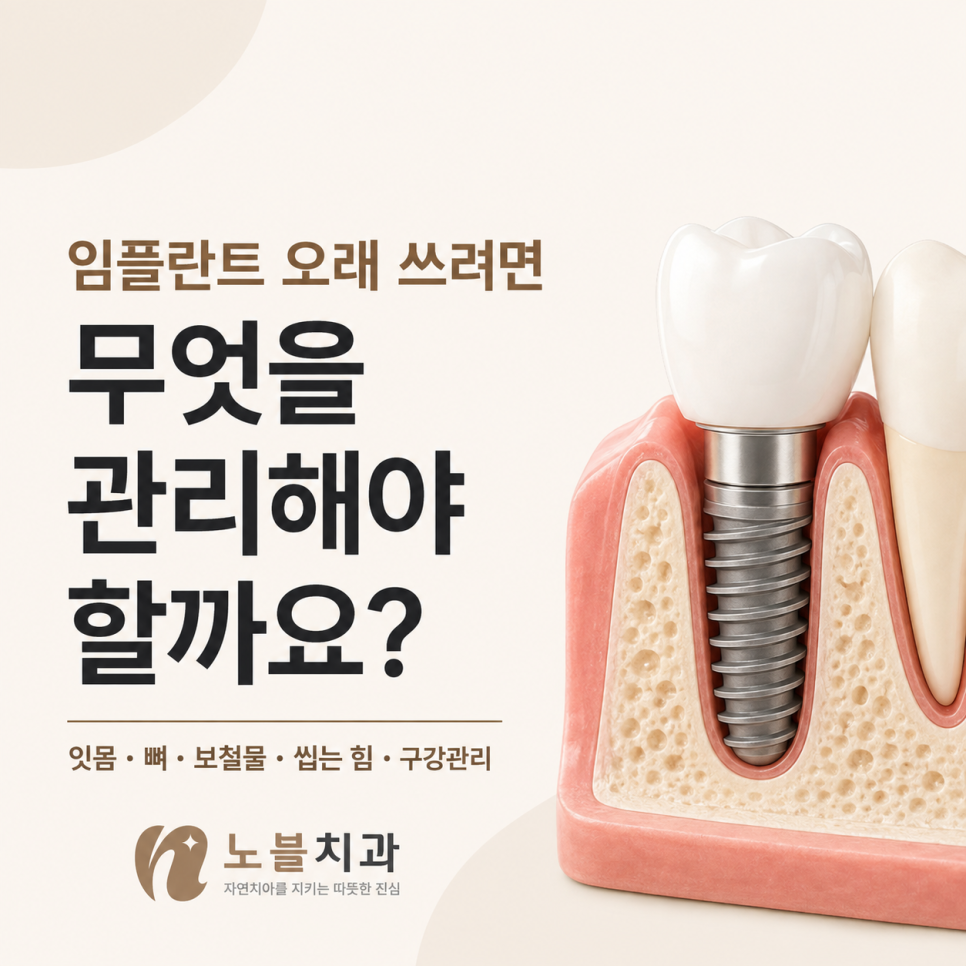 수원 임플란트 치과, 임플란트 오래 쓰려면 무엇을 관리해야 할까요?