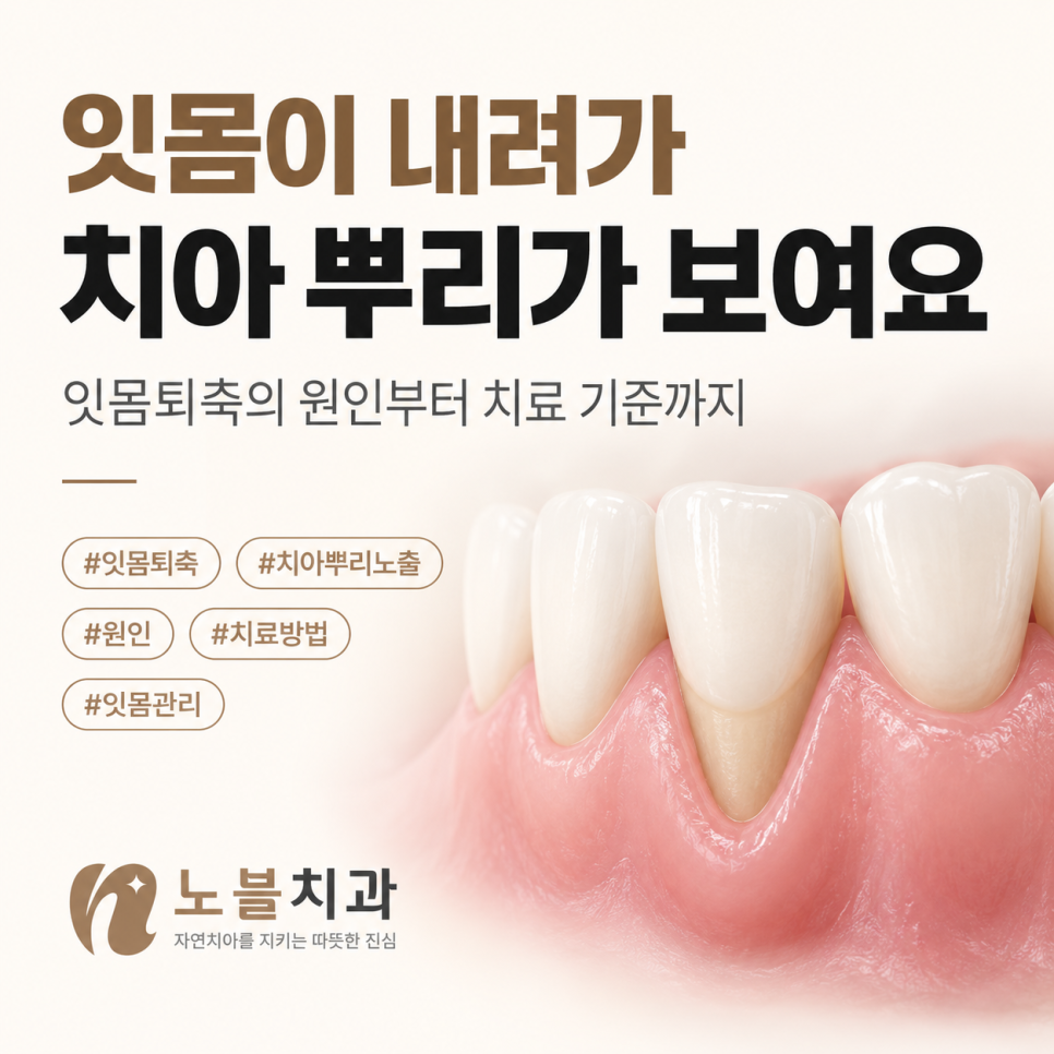잇몸퇴축의 원인부터 치료가 필요한 기준까지