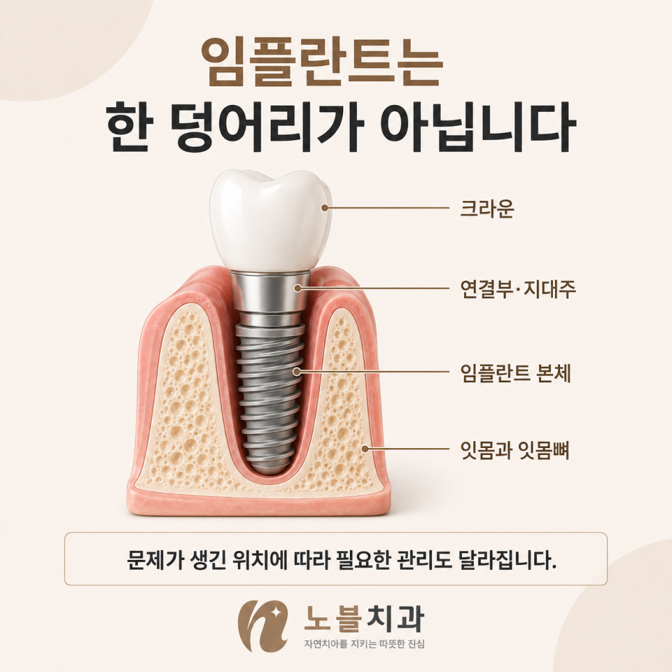 문제가 생긴 위치에 따라 필요한 관리도 달라집니다.