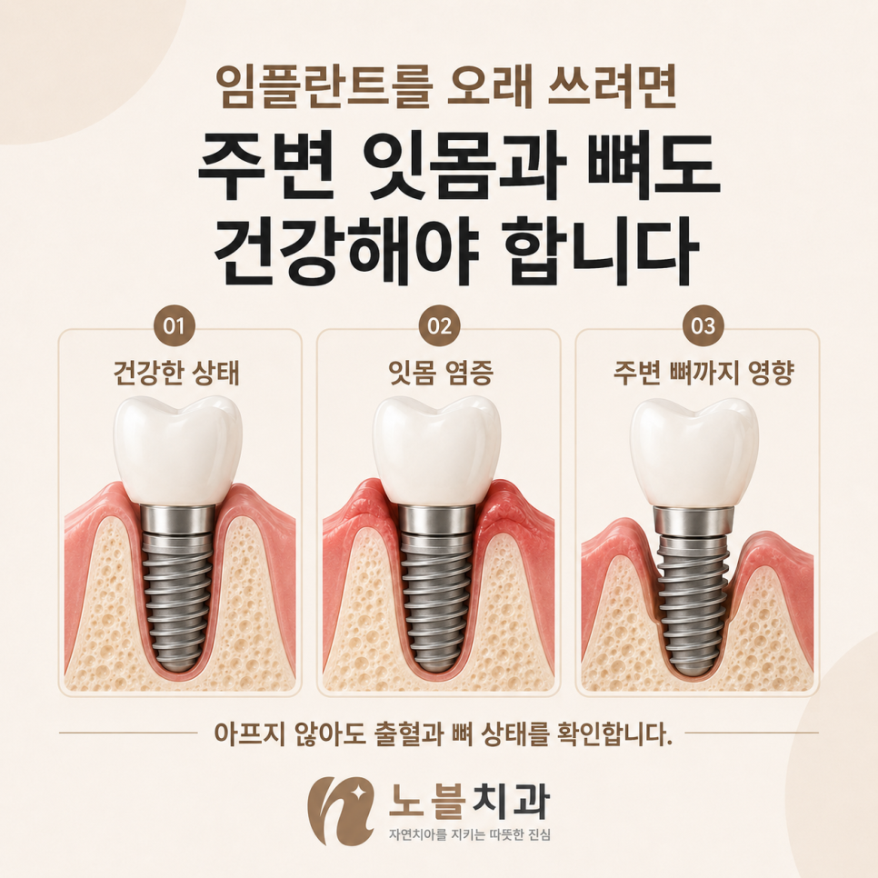아프지 않아도 출혈과 뼈 상태를 확인합니다.