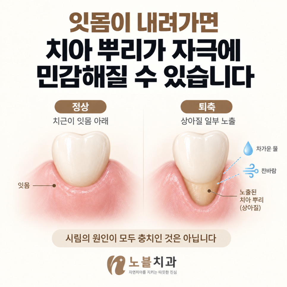 시림의 원인이 모두 충치인 것은 아닙니다.