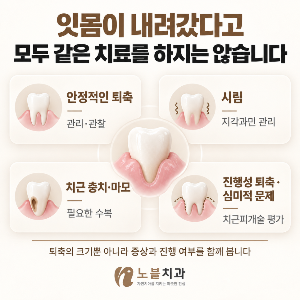 퇴축의 크기뿐 아니라 증상과 진행 여부를 함께 봅니다.