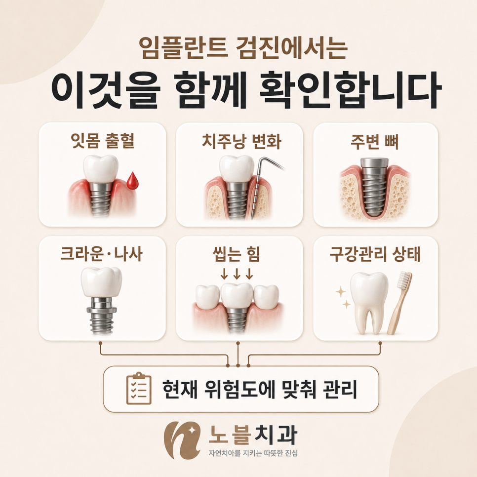 수원 임플란트 치과, 임플란트 오래 쓰려면 무엇을 관리해야 할까요?