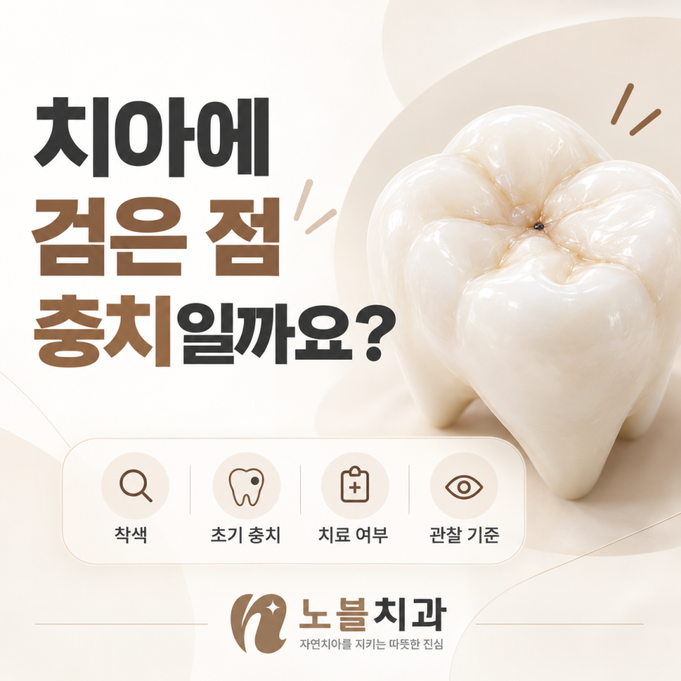 치아에 검은 점이 보인다면 충치일까? 장안구치과에서 확인하는 기준