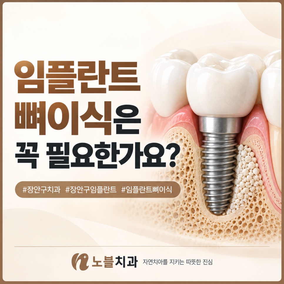 임플란트 뼈이식은 꼭 필요한가요?