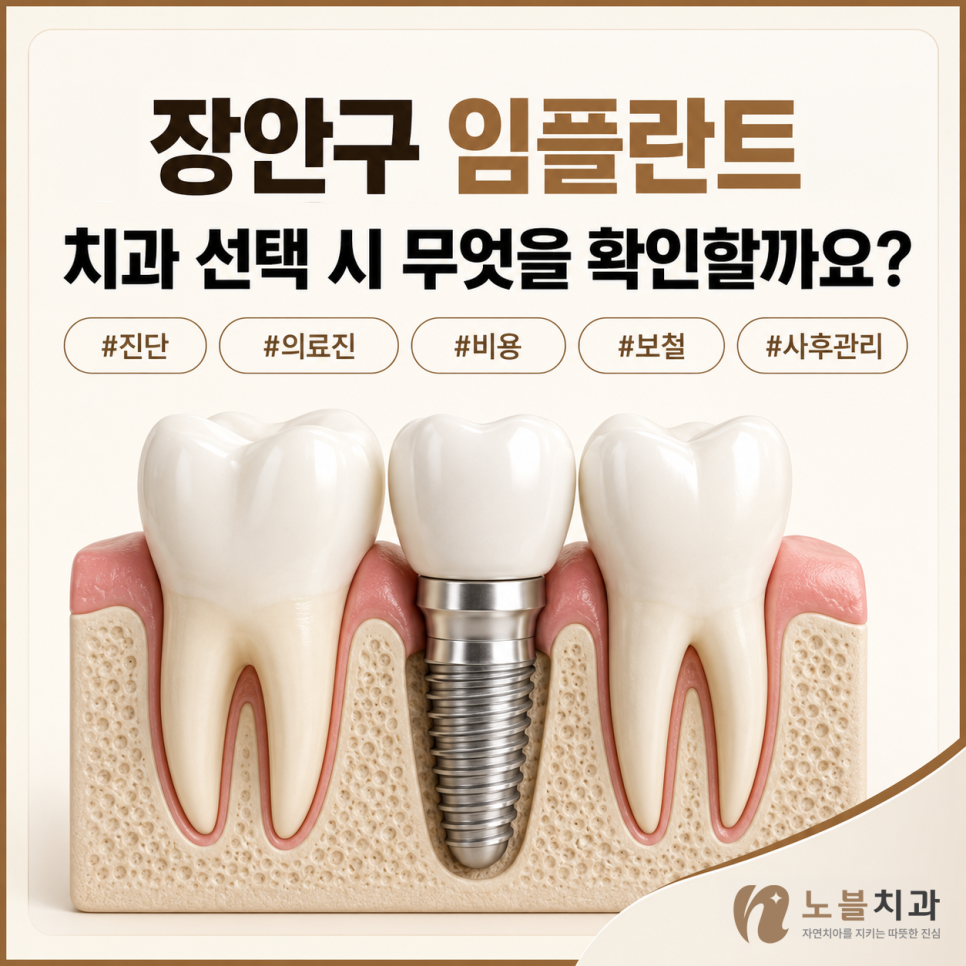 수원 장안구치과 임플란트 선택 시 참고사항, 상담에서 확인해야 할 7가지