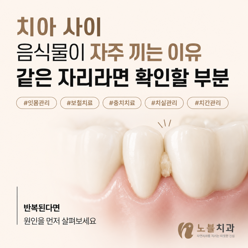 치아 사이 음식물이 자주 끼는 이유, 같은 자리라면 확인할 부분