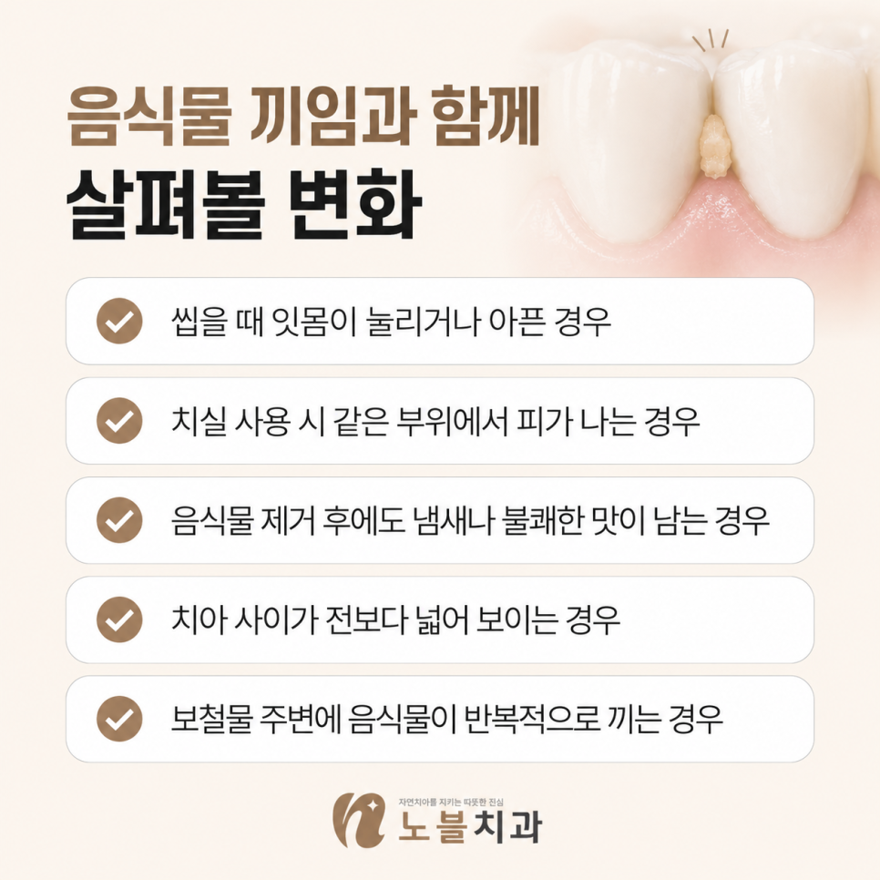 치아 사이 음식물이 자주 끼는 이유, 같은 자리라면 확인할 부분