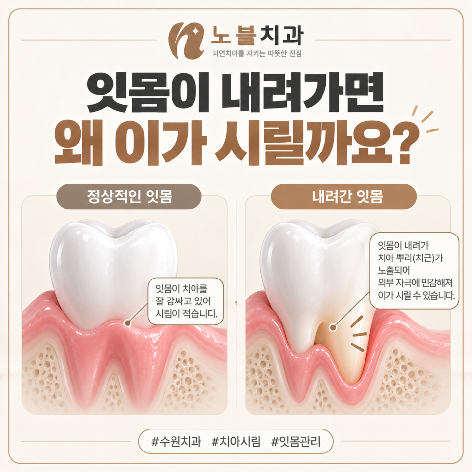 수원치과, 찬물 마실 때 이가 시리면 충치일까요?