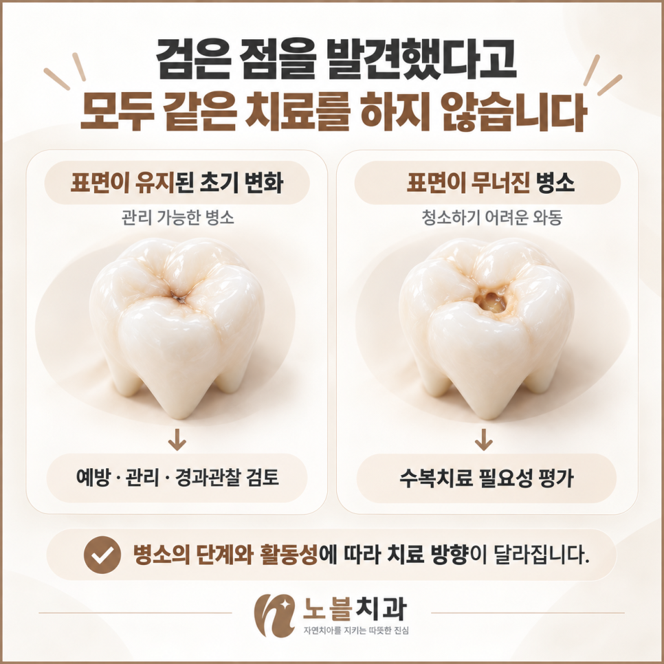 병소의 단계와 활동성에 따라 치료 방향이 달라집니다.