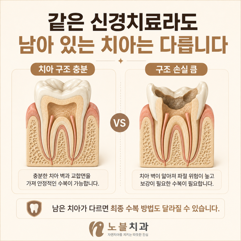 남아 있는 건강한 치아 구조를 먼저 확인합니다.