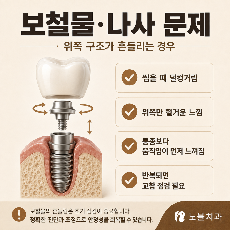 수원 치과 추천 기준, 임플란트가 흔들릴 때 확인해야 할 원인