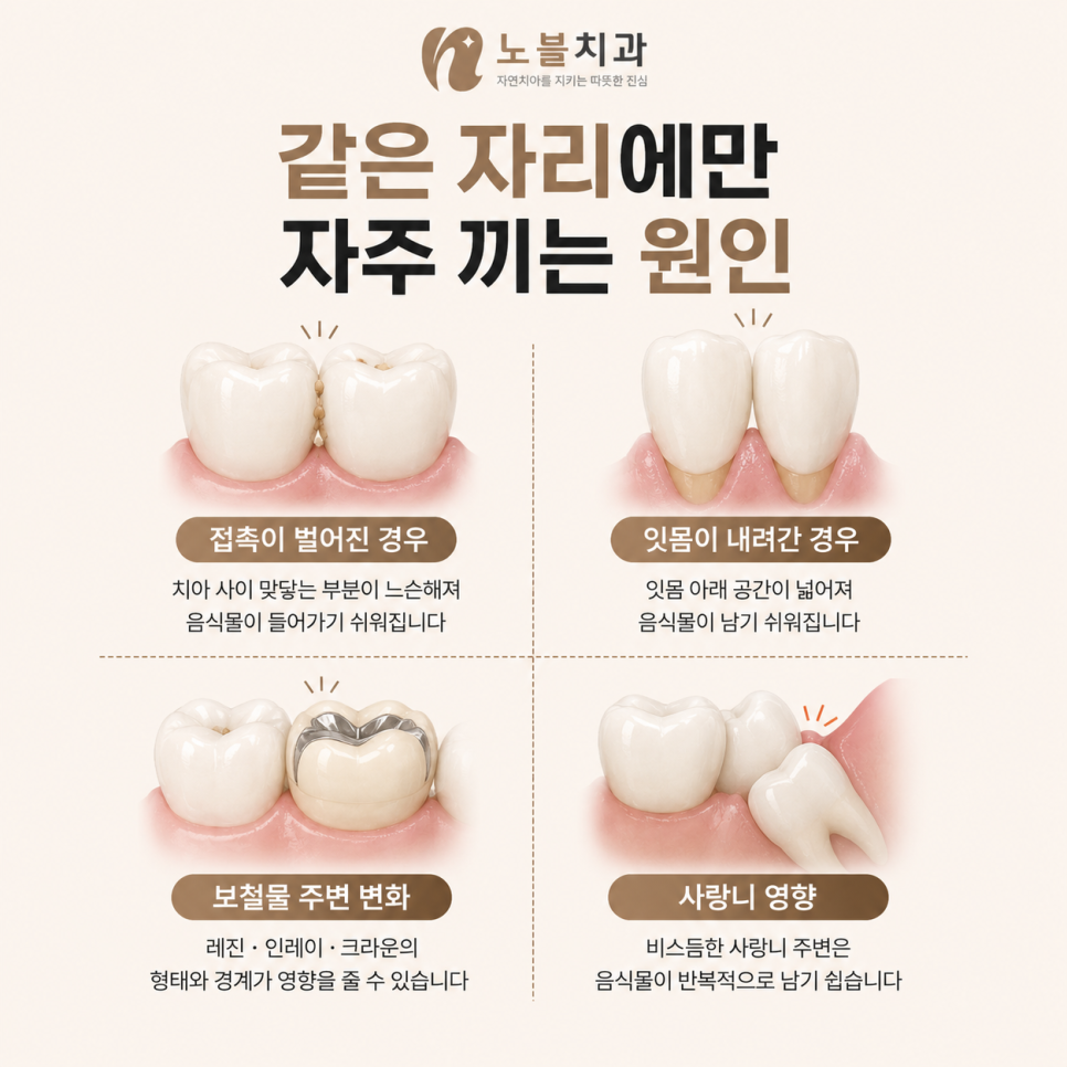 치아 사이 음식물이 자주 끼는 이유, 같은 자리라면 확인할 부분