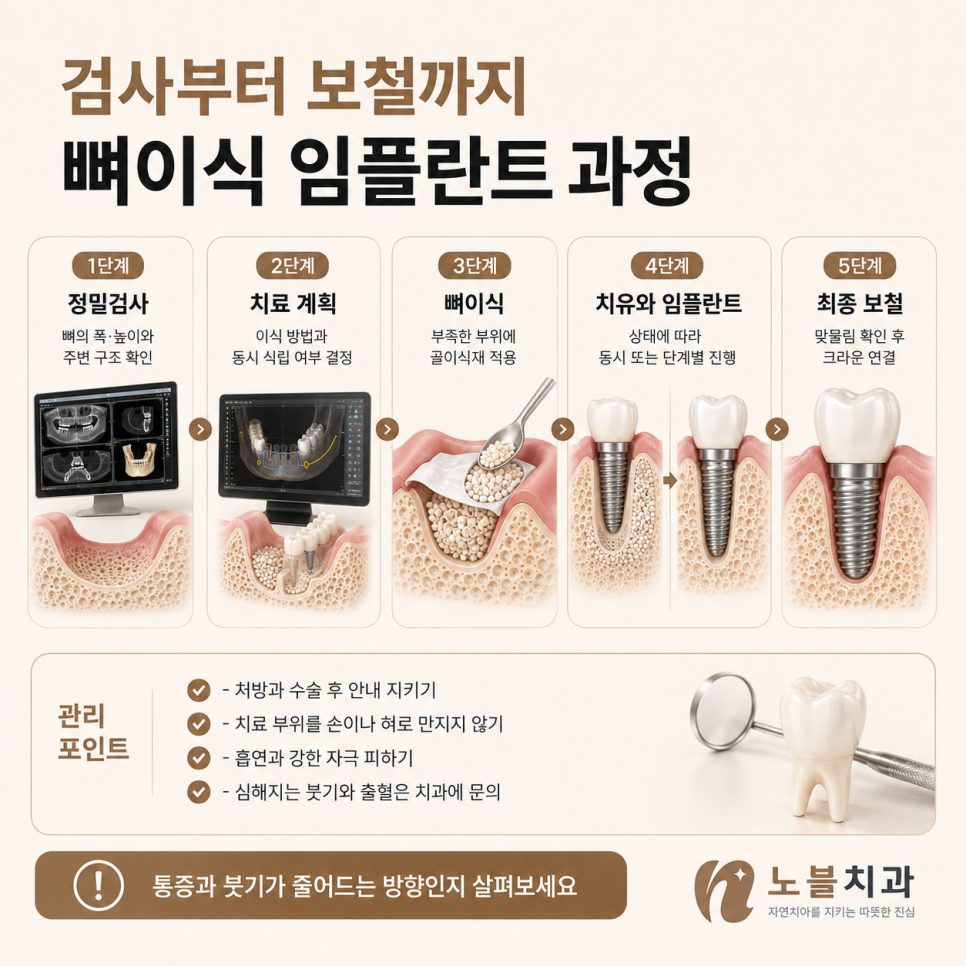 수원치과 뼈이식 임플란트는 언제 필요할까? 검사부터 회복까지