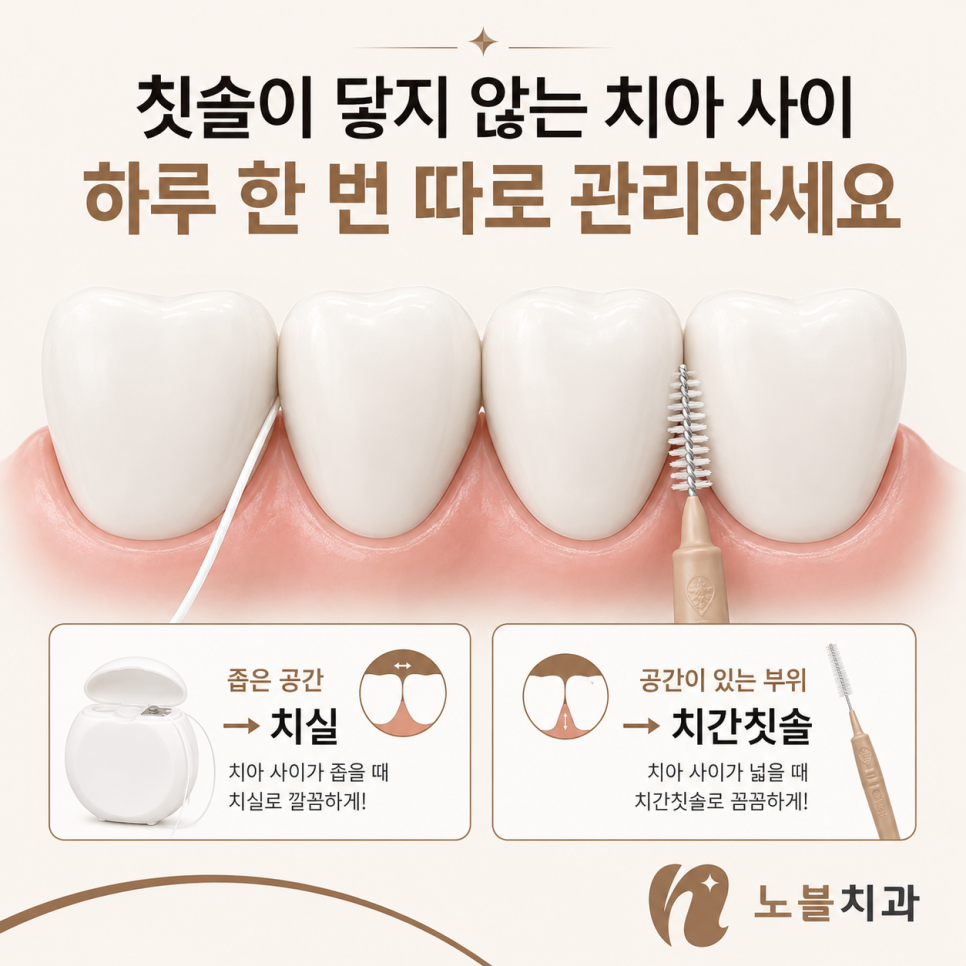 수원 치과 추천, 매일 양치해도 충치와 잇몸질환이 생기는 이유