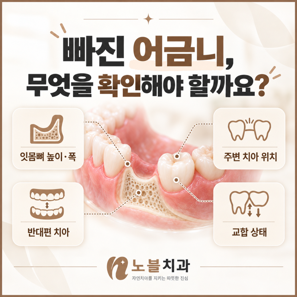 수원임플란트치과 빠진 어금니를 오래 방치하면 생기는 변화