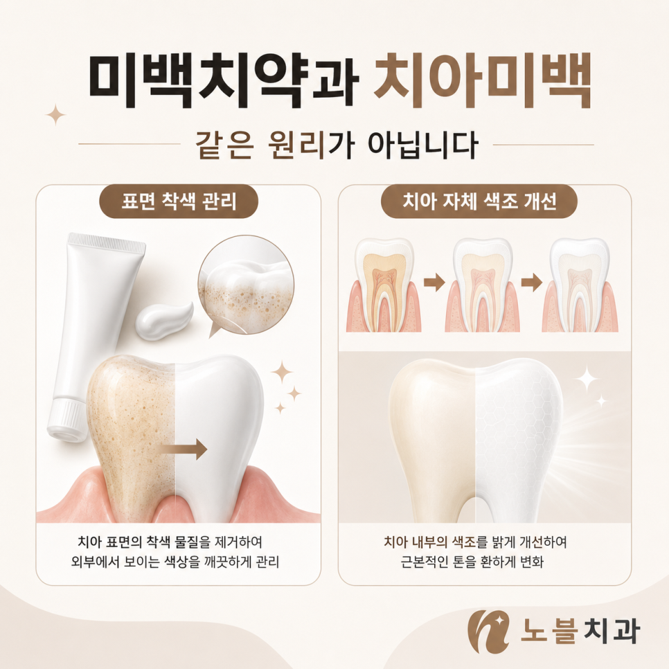 수원 치과 추천, 매일 양치해도 충치와 잇몸질환이 생기는 이유