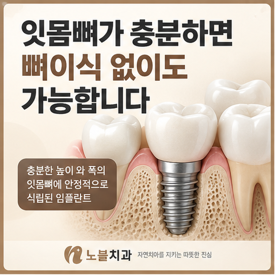 수원 장안구치과 임플란트 뼈이식은 꼭 필요한가요?