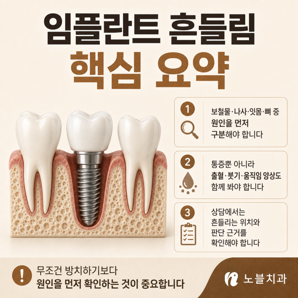 수원 치과 추천 기준, 임플란트가 흔들릴 때 확인해야 할 원인