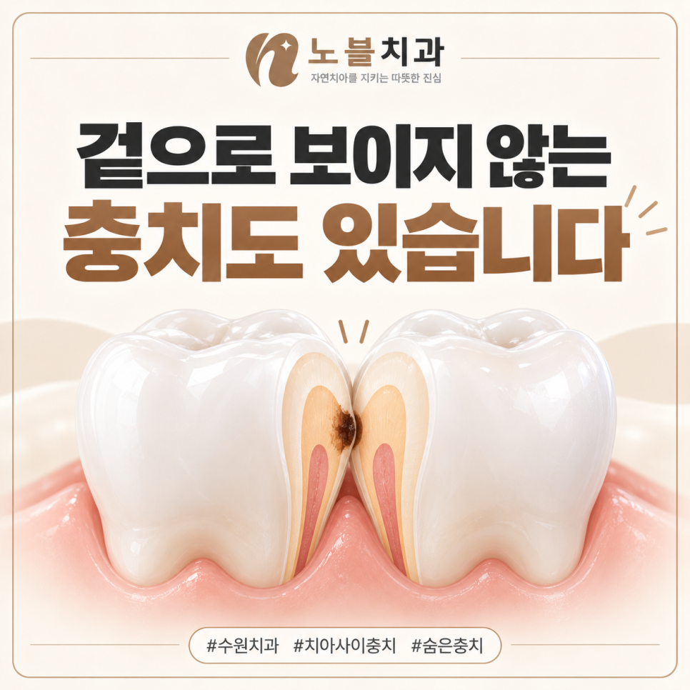 수원치과, 찬물 마실 때 이가 시리면 충치일까요?