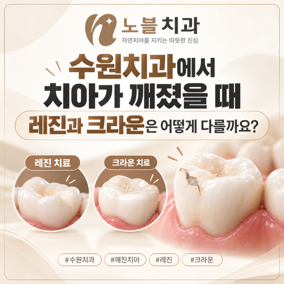 수원치과에서 치아가 깨졌을 때, 레진과 크라운은 어떻게 다를까요?