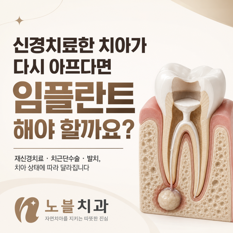 수원 임플란트, 신경치료한 치아가 다시 아프면 임플란트 해야 할까요?