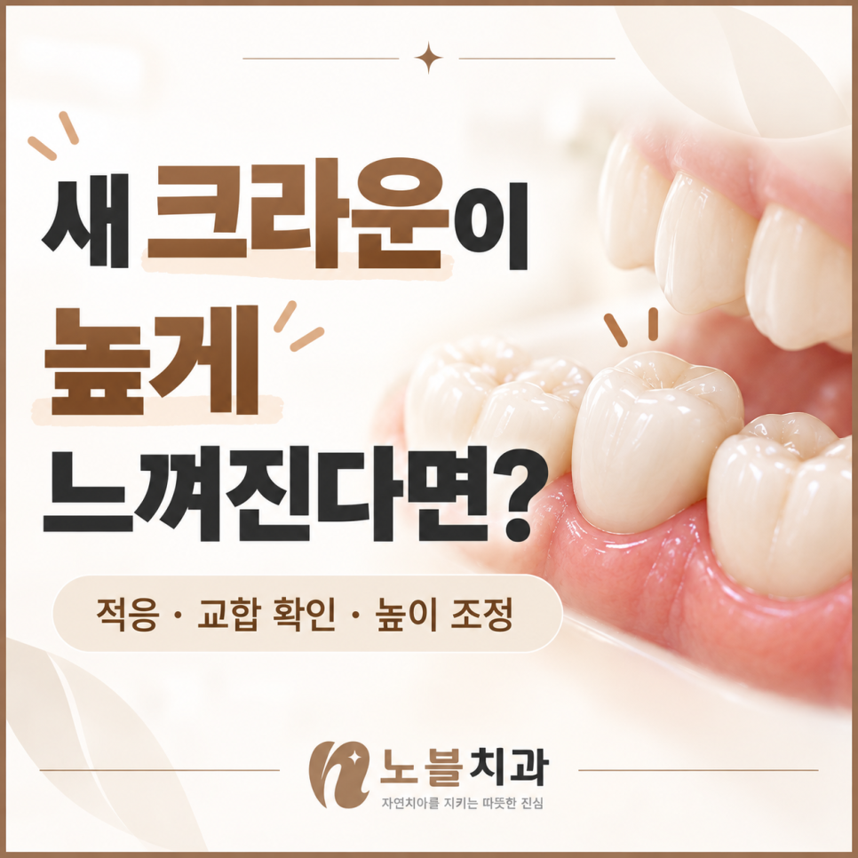 수원치과, 새로 씌운 크라운이 높게 느껴진다면 적응해야 할까요?