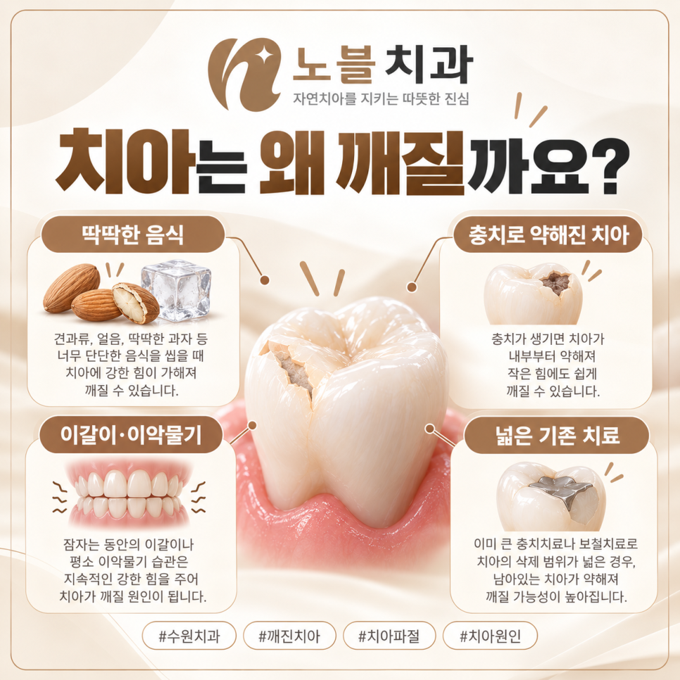 수원치과에서 치아가 깨졌을 때, 레진과 크라운은 어떻게 다를까요?