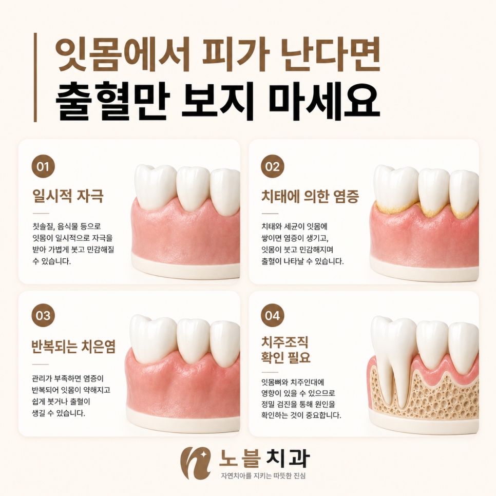 같은 출혈처럼 보여도 원인과 깊이는 다를 수 있습니다.