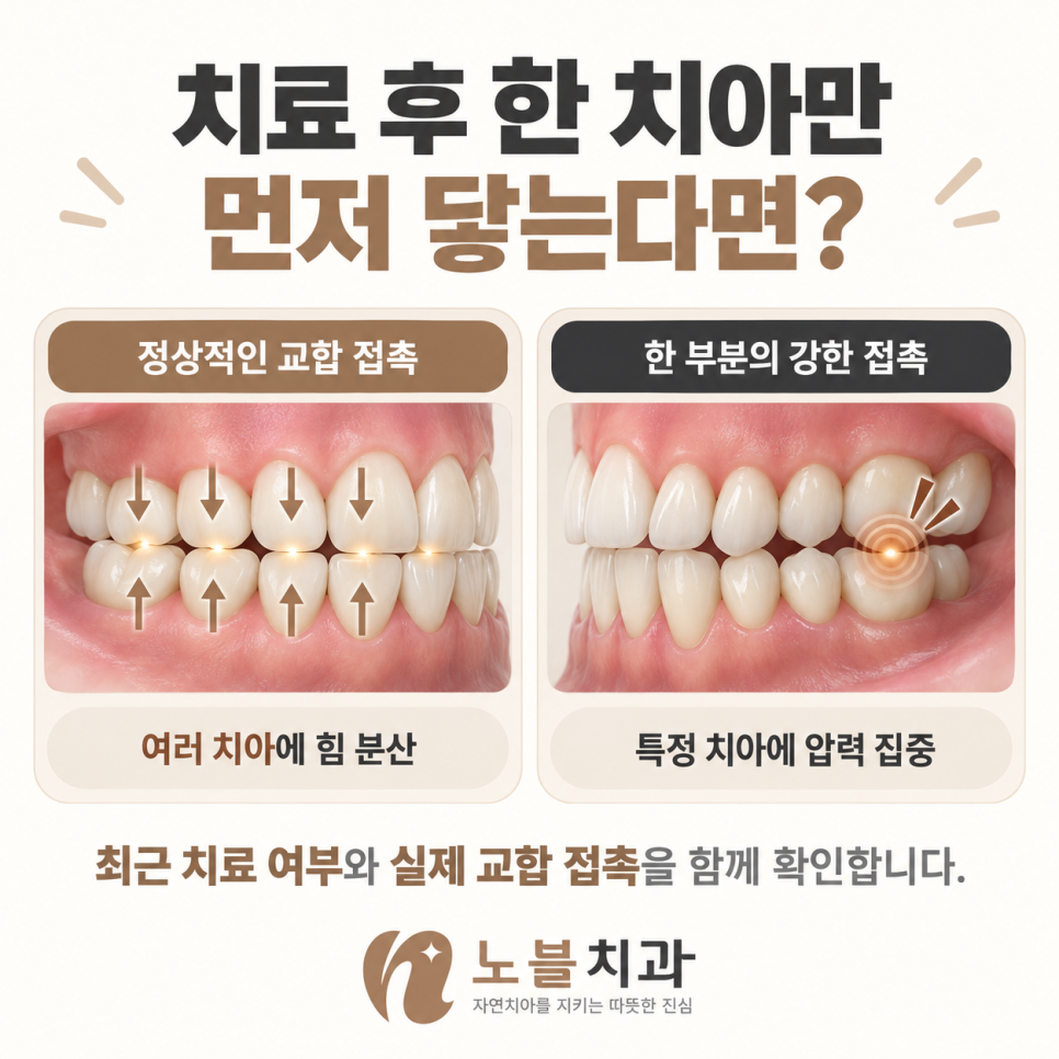 최근 치료 여부와 실제 교합 접촉을 함께 확인합니다.