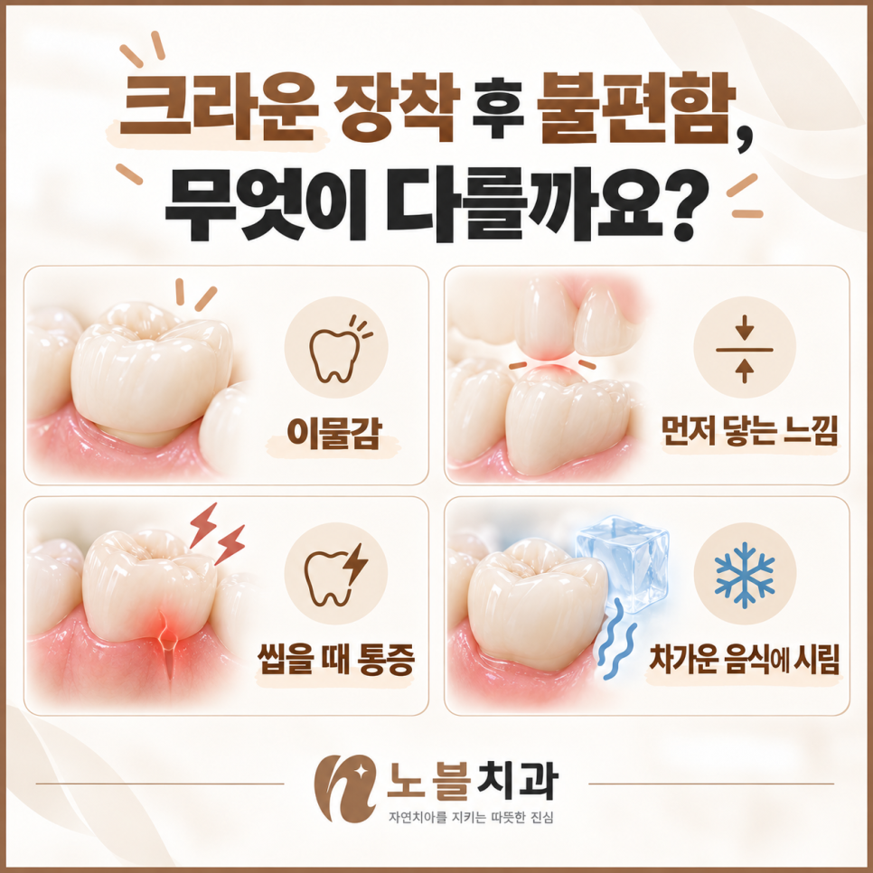 수원치과, 새로 씌운 크라운이 높게 느껴진다면 적응해야 할까요?