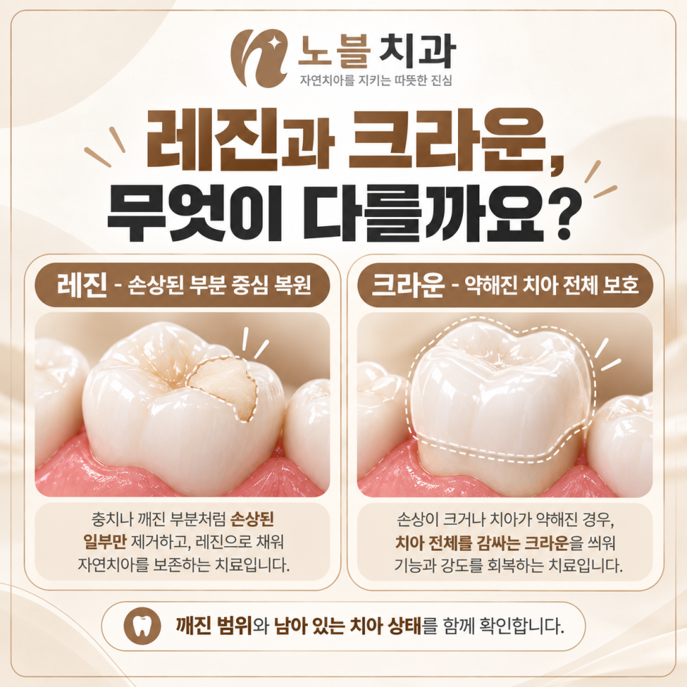 수원치과에서 치아가 깨졌을 때, 레진과 크라운은 어떻게 다를까요?