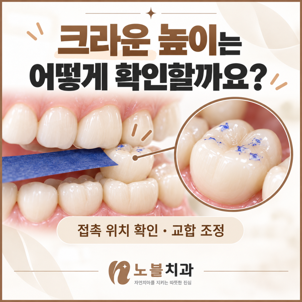 수원치과, 새로 씌운 크라운이 높게 느껴진다면 적응해야 할까요?
