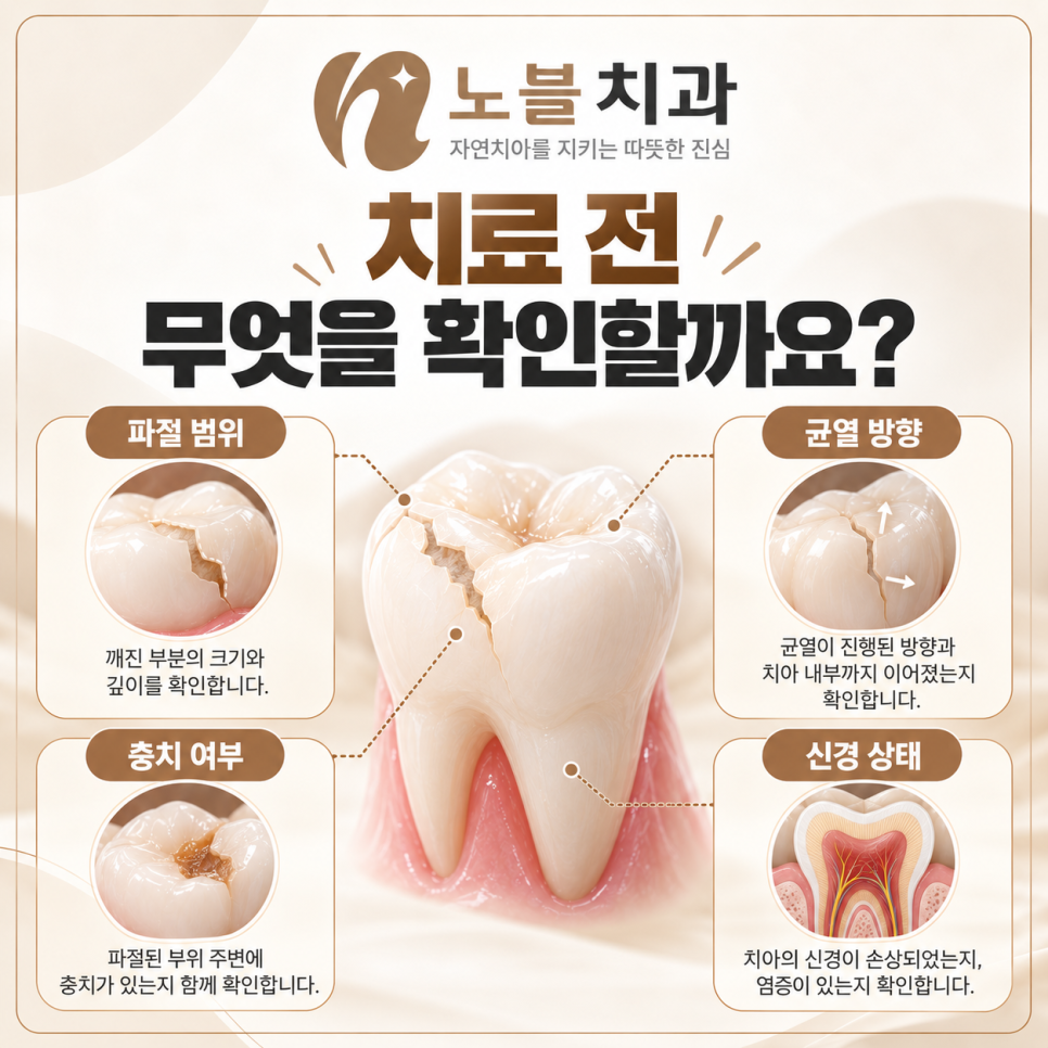 수원치과에서 치아가 깨졌을 때, 레진과 크라운은 어떻게 다를까요?